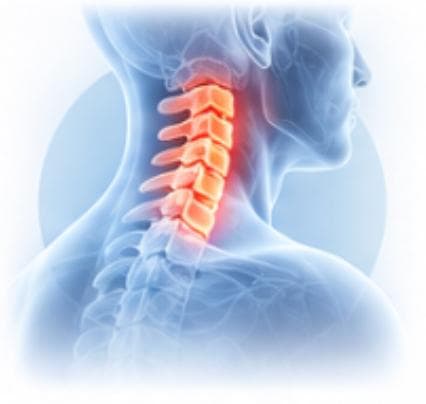 Cervical Spine Surgery